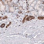 VMAT2 Monoclonal Antibody (CL12531)