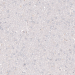 VMAT2 Antibody in Immunohistochemistry (Paraffin) (IHC (P))