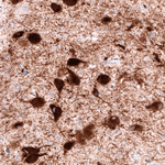 VMAT2 Antibody in Immunohistochemistry (Paraffin) (IHC (P))