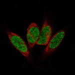 GLI1 Monoclonal Antibody (CL12191)