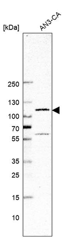 GLI1 Antibody in Western Blot (WB)