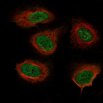 NF1 Monoclonal Antibody (CL11773)