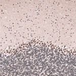 GLI1 Antibody in Immunohistochemistry (Paraffin) (IHC (P))