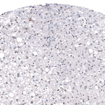 GLI1 Antibody in Immunohistochemistry (Paraffin) (IHC (P))