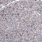 GLI1 Antibody in Immunohistochemistry (Paraffin) (IHC (P))