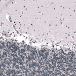 GLI1 Antibody in Immunohistochemistry (Paraffin) (IHC (P))