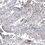 GLI1 Antibody in Immunohistochemistry (Paraffin) (IHC (P))