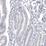 SAA Antibody in Immunohistochemistry (Paraffin) (IHC (P))