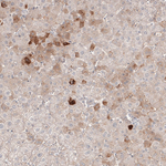 SAA Monoclonal Antibody (CL9175)