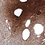 SAA Antibody in Immunohistochemistry (Paraffin) (IHC (P))