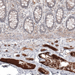 SAA Antibody in Immunohistochemistry (Paraffin) (IHC (P))