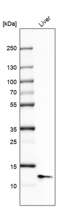 SAA Antibody in Western Blot (WB)