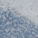 MCL-1 Antibody in Immunohistochemistry (Paraffin) (IHC (P))