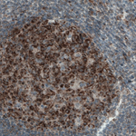 MCL-1 Antibody in Immunohistochemistry (Paraffin) (IHC (P))
