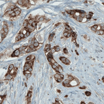MCL-1 Antibody in Immunohistochemistry (Paraffin) (IHC (P))
