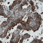 MCL-1 Antibody in Immunohistochemistry (Paraffin) (IHC (P))