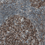MCL-1 Antibody in Immunohistochemistry (Paraffin) (IHC (P))