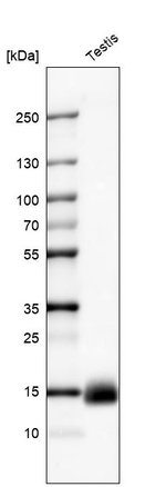 CTAG1B Monoclonal Antibody (CL10130)