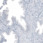 MUC2 Antibody in Immunohistochemistry (Paraffin) (IHC (P))