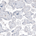 MUC2 Antibody in Immunohistochemistry (Paraffin) (IHC (P))