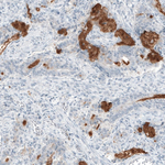 MUC2 Antibody in Immunohistochemistry (Paraffin) (IHC (P))