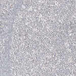 Mammaglobin A Antibody in Immunohistochemistry (Paraffin) (IHC (P))