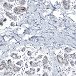Mammaglobin A Antibody in Immunohistochemistry (Paraffin) (IHC (P))