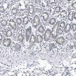 Mammaglobin A Antibody in Immunohistochemistry (Paraffin) (IHC (P))