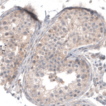 CD30 Antibody in Immunohistochemistry (Paraffin) (IHC (P))