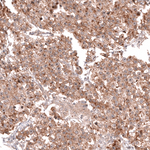 CD30 Antibody in Immunohistochemistry (Paraffin) (IHC (P))