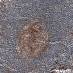 CD30 Antibody in Immunohistochemistry (Paraffin) (IHC (P))