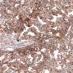 CD30 Monoclonal Antibody (CL12632)