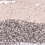 GLI1 Antibody in Immunohistochemistry (Paraffin) (IHC (P))