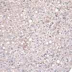 GLI1 Antibody in Immunohistochemistry (Paraffin) (IHC (P))
