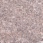GLI1 Antibody in Immunohistochemistry (Paraffin) (IHC (P))