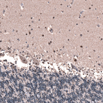 GLI1 Monoclonal Antibody (CL12192)