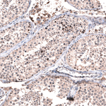 GLI1 Antibody in Immunohistochemistry (Paraffin) (IHC (P))