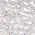 CD99 Antibody in Immunohistochemistry (Paraffin) (IHC (P))