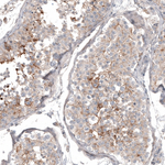CD99 Antibody in Immunohistochemistry (Paraffin) (IHC (P))