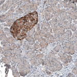 CD99 Antibody in Immunohistochemistry (Paraffin) (IHC (P))