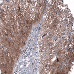 CD99 Antibody in Immunohistochemistry (Paraffin) (IHC (P))