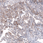 CD99 Antibody in Immunohistochemistry (Paraffin) (IHC (P))