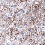 CD99 Antibody in Immunohistochemistry (Paraffin) (IHC (P))