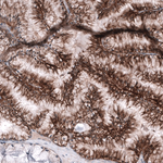 CD99 Monoclonal Antibody (CL12929)