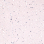 CD21 Antibody in Immunohistochemistry (Paraffin) (IHC (P))
