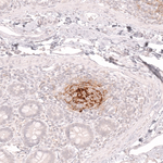 CD21 Antibody in Immunohistochemistry (Paraffin) (IHC (P))