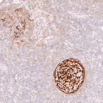 CD21 Antibody in Immunohistochemistry (Paraffin) (IHC (P))