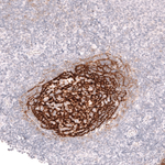 CD21 Antibody in Immunohistochemistry (Paraffin) (IHC (P))