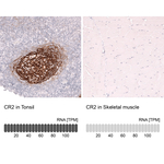 CD21 Antibody in Immunohistochemistry (Paraffin) (IHC (P))