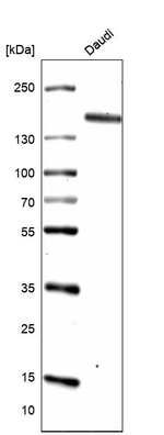 CD21 Antibody in Western Blot (WB)